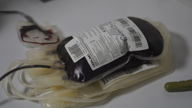 Rare blood types and the need for blood banks to diversify samples